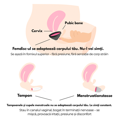 Femisc Menstrual Disc with Removal Tab