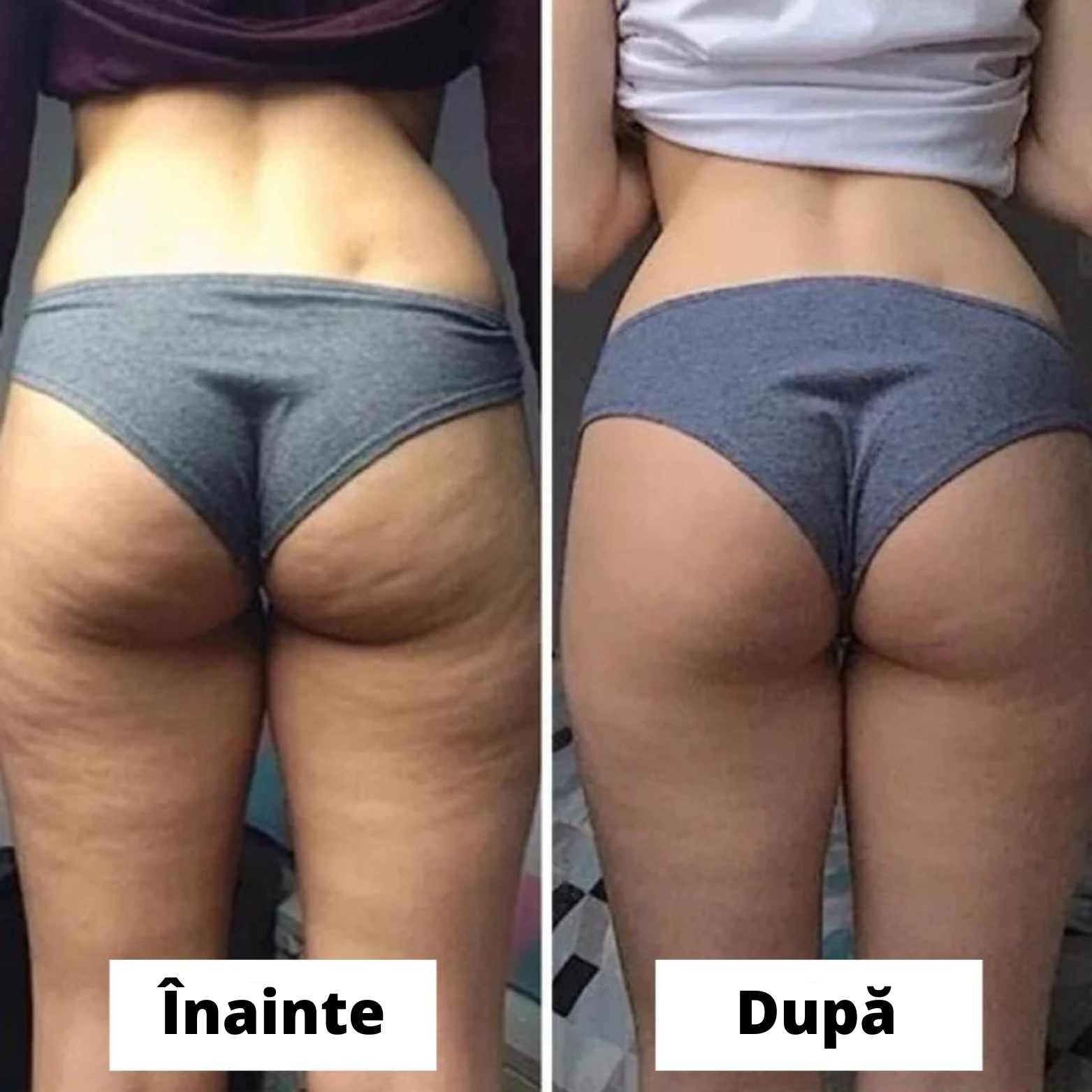 Celulită Ulei de masaj