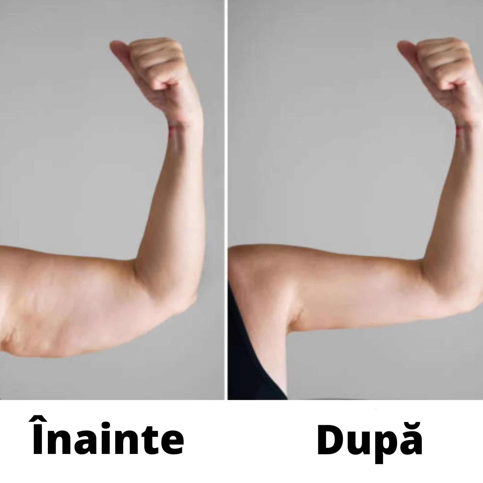 Celulită Ulei de masaj